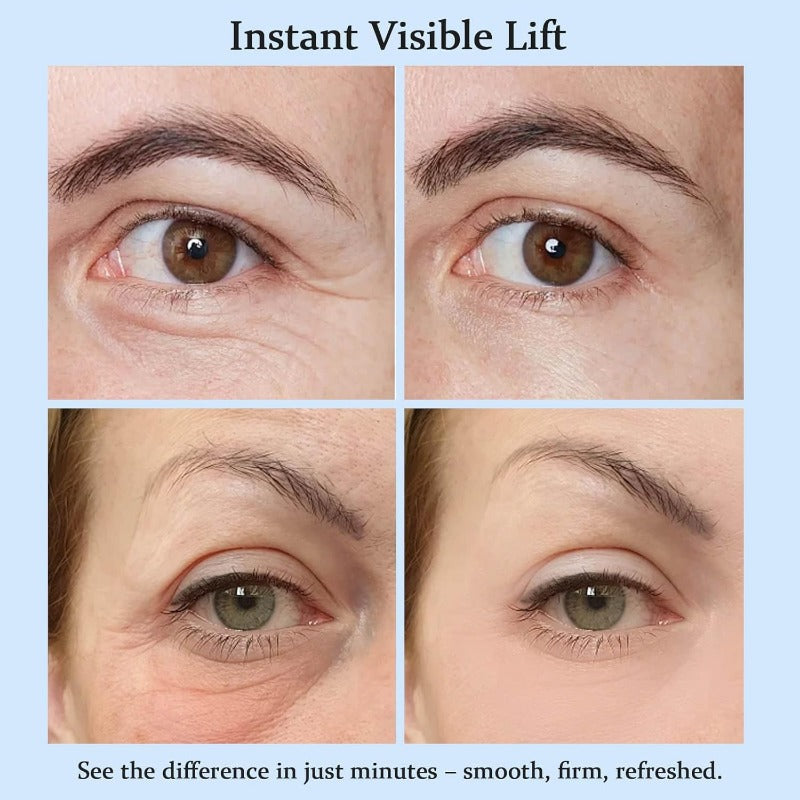 YoPoll Instant Eye Lift Cream lift en verfrist vermoeide ogen
