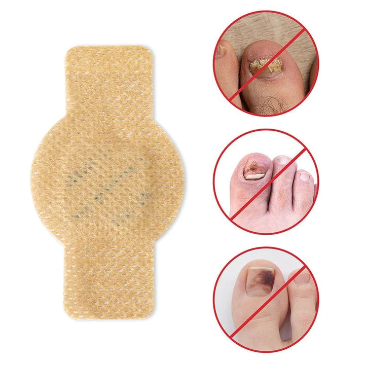 FungalPatch - Antibacterieel Schimmelwerend Patch En Nagelverzorging Pak