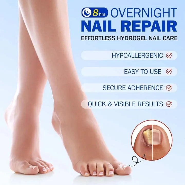 FungalPatch - Antibacterieel Schimmelwerend Patch En Nagelverzorging Pak